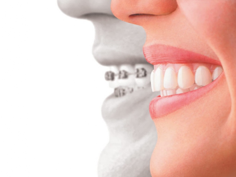 Malocclusioni dentali: dalle moderne analisi ai trattamenti